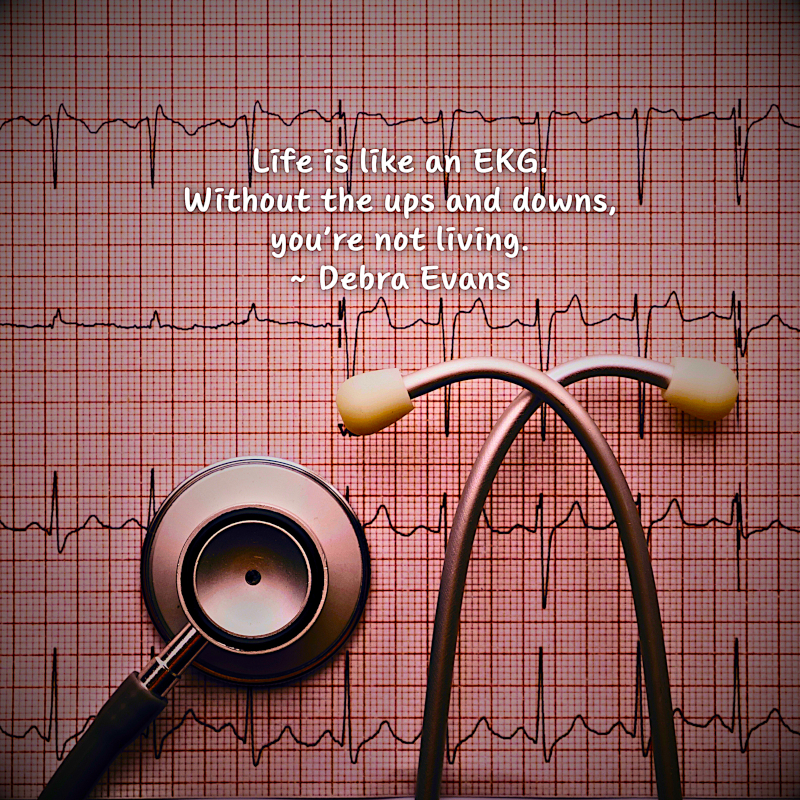 Life is like an EKG